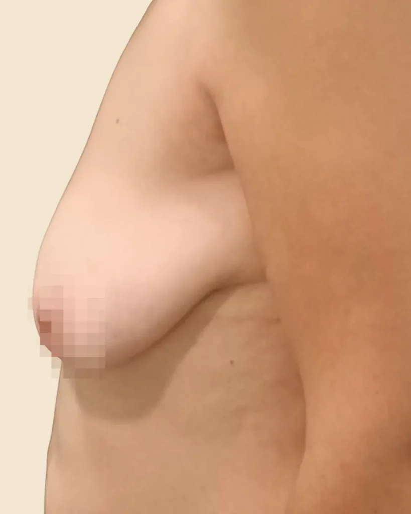 Antes